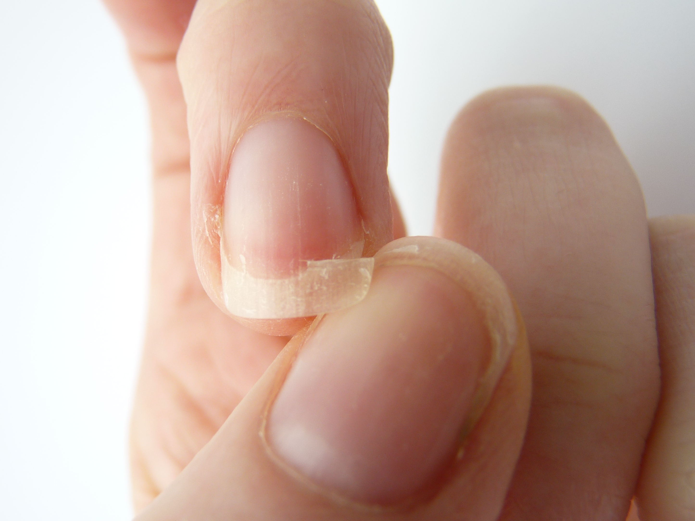 nail problems and what they mean fingernail problem pictures and descriptions big toe nail problem