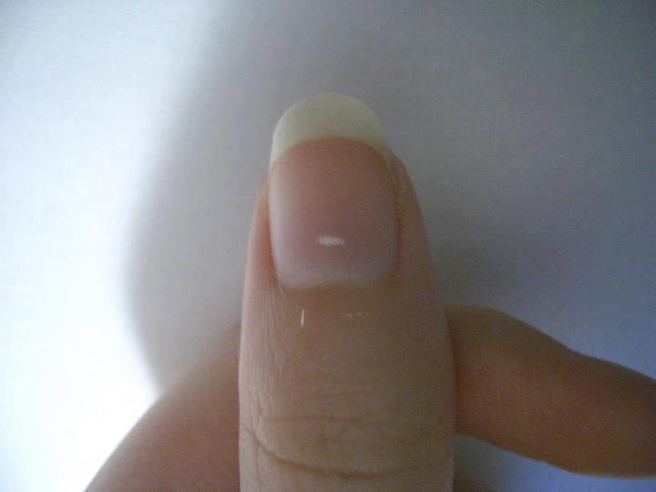 flat fingernails symptom nail diseases and disorders chart how to take care of fingernails
