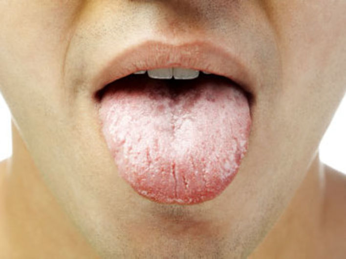 tongue color indications